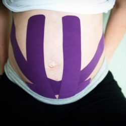 Kinesiotaping – fizjoterapia dla kobiet w ciąży!